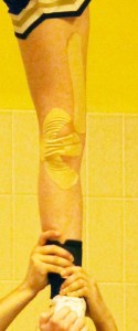 Kinesio tape supporting Knee