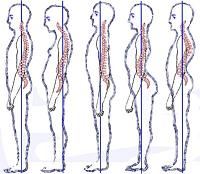 posture_photo_vertebral_spine-correct50