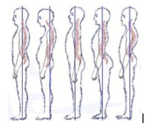 Postural Positions