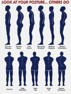 posture with osteoporosis